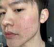 OHBT男士保湿面霜水杨酸维生素b5控油祛痘补水焕白提亮抗皱紧致护肤品 实拍图