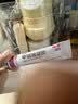 丽芙甲硝唑凝胶20g*2盒甲硝酸锉凝胶去痘痘祛痘印药膏消炎痤疮修复淡化可搭壬二酸15%凝胶皮肤用药 实拍图