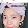 Newliann医用冷敷贴面膜械字号敷料重组胶原蛋白晒后修复医美术后补水保湿 实拍图