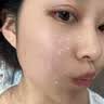 澳珀妮去角质啫喱面部去死皮去黑头粉刺控油深层清洁痘痘收缩毛孔男女士 实拍图