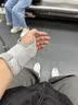 CRALVKOIN医用腕关节固定支具腕部骨折透气支撑腱鞘炎护腕手腕拉伤韧带损伤 实拍图