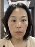 欧莱雅紫熨斗眼霜20ml玻色因全脸淡化细纹抗皱护肤品生日礼物 实拍图