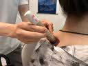 羽藤制药日本肩周炎专用膏药贴肩膀酸疼痛劳损伤抬臂困难胳膊抬不起僵硬3 实拍图