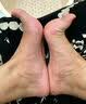 日本拇指外翻贴膏脚趾变形矫正器贴大拇矫炎疼痛拇指变形重叠大脚骨突出大拇指外翻成人儿童拇外翻矫正 【大脚骨突出】周期装二送一 实拍图