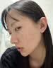 维特丝祛痘膏壬二酸15%凝胶祛痘印青少年专用淡痘印水杨酸胶态硫烟酰胺 实拍图