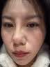 维特丝377面霜乳液男女士美白祛斑紧致高保湿补水去黄提亮黑色素护肤品 实拍图