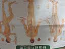 康祝真空拔罐器家用套装京东自营正品夏季拔火罐去湿气中医专用送礼 实拍图
