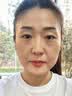 维特丝377面霜乳液男女士美白祛斑紧致高保湿补水去黄提亮黑色素护肤品 实拍图