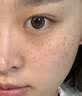 羽藤制药日本进口成分医美用烟酰胺凝胶祛斑美白淡化黑色素脸部军训专用3 实拍图