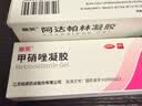 丽芙阿达帕林凝胶0.1%*16g/支*2第三代维a酸乳膏改善毛孔粗大去黑头医用正品祛痘痤疮专用青少年修复淡化痘印 实拍图