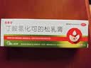 尤卓尔丁酸氢化可的松乳膏 0.1% 20g：20mg *20g 过敏性皮炎脂溢性皮炎过敏性湿疹及苔藓样瘙痒症 实拍图