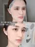 Newliann医用冷敷贴面膜械字号敷料重组胶原蛋白晒后修复医美术后补水保湿 实拍图