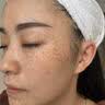 OHBT面膜美白淡斑补水保湿男女士熬夜舒缓抗皱紧致去黄气暗沉提亮肤色 实拍图