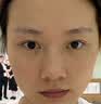 羽藤制药日本进口成分医美用烟酰胺凝胶祛斑美白淡化黑色素脸部军训专用3 实拍图