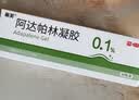 丽芙阿达帕林凝胶0.1%*35g第三代维a酸乳膏祛痘印改善毛孔粗大去黑头医用正品祛痘痤疮专用青少年修复药膏 实拍图