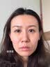 透真377美白祛斑淡化黑色素雀斑抗皱紧致淡纹面部玫瑰精华油去黄次抛 实拍图