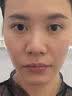 维特丝面膜美白淡斑补水保湿男女士熬夜舒缓抗皱紧致去黄气暗沉提亮肤色 实拍图