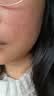 优斐斯【双11抢购】传明酸美白淡斑精华液氨甲环酸祛斑提亮肤色淡色沉 实拍图