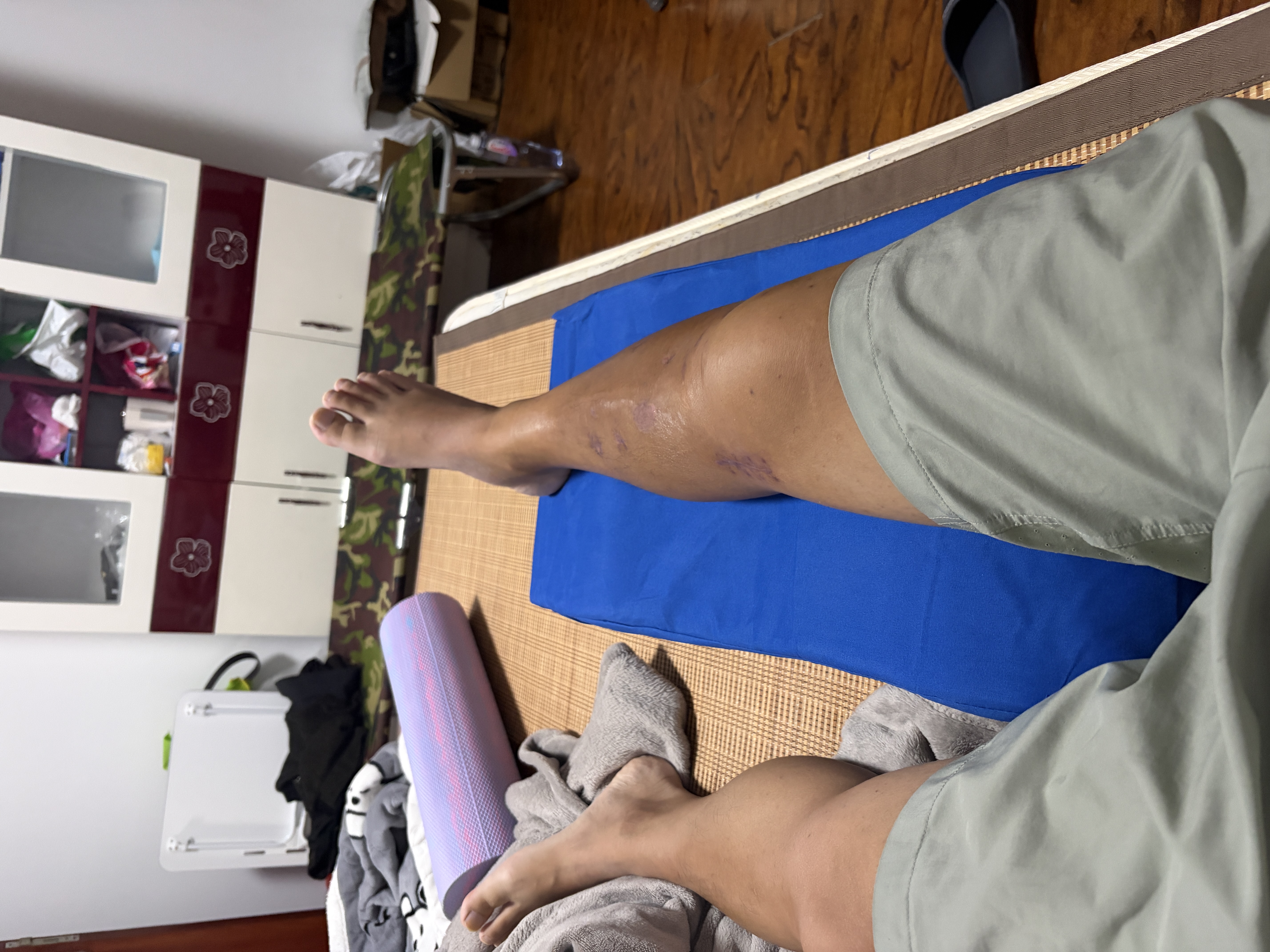 合佳下肢抬高垫三角枕骨折神器床上翻身器垫下肢康复垫腿脚骨折垫腿部 实拍图