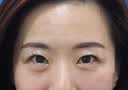 白云山眼部抗皱植萃精华油紧致淡化细纹眼袋黑眼圈补水保湿两瓶装40ml 实拍图