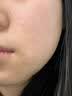 华美科医用修复皮肤屏障受损泛红修护乳液全能面霜补水保湿械字号1支 实拍图