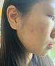 美白祛斑精华液化妆品护肤品补水保湿提亮肤色 1盒14瓶 实拍图