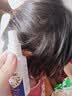 修正百部酊喷剂虱子床虱虱卵跳蚤阴虱男女私处儿童头发虱卵虱立净 实拍图