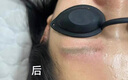 TANZI璀璨810多功能洗脱一体机小型拉杆箱黑科技洗眉机大功率美容院用 【810/双手柄】洗脱一体/银色/五头 实拍图