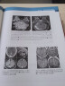 现货 脑部疾病影像诊断 病理与解剖 涵盖神经影像学与神经病理学的主要领域 放射医学 程敬亮 等主译 9787117324434人民卫生出版社 晒单实拍图