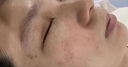 TANZI院线级810拉杆箱脱毛仪冰点激光脱毛光子嫩肤爆款家用美容院仪器 升级款【双风扇】黑色 十靶条 实拍图