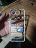 XP适用小米17pro手机壳镜头全包xiaomi17pro透明软保护外壳散热硅胶男女生防摔高级感-蓝框不发脾气 实拍图