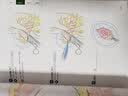 腹腔镜下胃癌根治术(翻译版) 实拍图