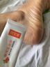 今九润宝康【官方店铺】皲裂脚后跟干裂膏脚裂手足开裂儿童脸耳冻伤膏 1盒【体验装】运费贵 不推荐 实拍图