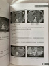 临床CT诊断图谱 实拍图