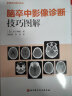 脑卒中影像诊断技巧图解 影像诊断 读片技巧 影像解剖 北京科学技术 晒单实拍图