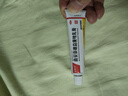 朝晖乐曲安奈德益康唑乳膏15g 皮炎湿疹手足癣体癣ZQ 1盒装 实拍图