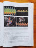 医学超声影像学（第2版 供医学影像学专业用）（本科影像/配增值） 实拍图