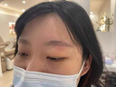 TANZI璀璨810多功能洗脱一体机小型拉杆箱黑科技洗眉机大功率美容院用 【810/双手柄】洗脱一体/黑色/六头 实拍图
