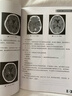 临床CT诊断图谱 实拍图