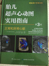 胎儿超声心动图实用指南：正常和异常心脏（第3版） 实拍图