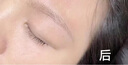 TANZI璀璨810多功能洗脱一体机小型拉杆箱黑科技洗眉机大功率美容院用 【810/双手柄】洗脱一体/银色/六头 实拍图