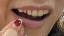 DALEK 戴立克二氧化锆全瓷牙烤瓷牙套牙冠牙齿假牙美白牙齿 3M蛀牙补牙超声波洗牙洁牙全瓷超薄贴面 爱尔创全瓷牙 实拍图