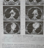 医学影像学读片诊断图谱：胸部分册 实拍图