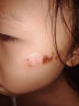 仁和儿童祛疤膏祛疤痕专用修复小孩抓摔伤宝宝脸部划伤手术疤缝针面部疤痕凹凸无痕除修复凝胶 单盒装 实拍图
