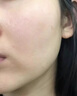 修正敏感肌修复面霜脸部泛红红血丝修复角质层薄增厚激素红高原红保湿 修护三件套B【水+精华+霜】 实拍图