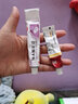 马应龙 尿素乳膏 手足皲裂膏 角化型手足癣手脚开裂 手脚干裂皮肤外用软膏 3盒尿素乳膏+1盒维a酸乳膏 鸡皮肤混合使用 实拍图