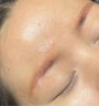 TANZI璀璨810多功能洗脱一体机小型拉杆箱黑科技洗眉机大功率美容院用 【810/双手柄】洗脱一体/黑色/五头 实拍图
