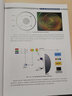 图说超广角荧光素眼底血管造影（图说眼科系列） 晒单实拍图