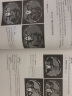 医学影像学读片诊断图谱 胸部分册 头颈分册 腹部分册 骨肌分册 4本套装放射医学参考书 医学影像 人民卫生出版社出版社 实拍图