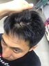 兆丽健营养生活【官方直营】北美进口兆丽健黑丝牌黑果枸杞桑葚复合胶囊搭叶酸白发转变黑根部营养液黑头发食疗用 四瓶周期装- 3瓶价 实拍图